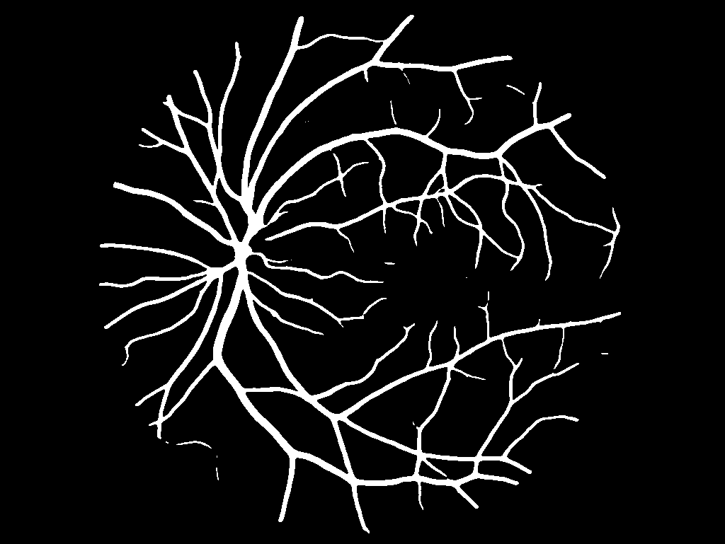 Binary vessel segmentation mask